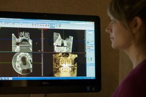 Planmeca Cone Beam Scanner